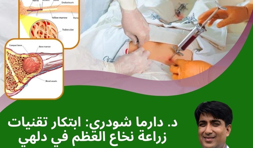 الخبرات الطبية العربية الحقيقية في الهند: د. دارما شودري: ابتكار تقنيات زراعة نخاع العظم في دلهي