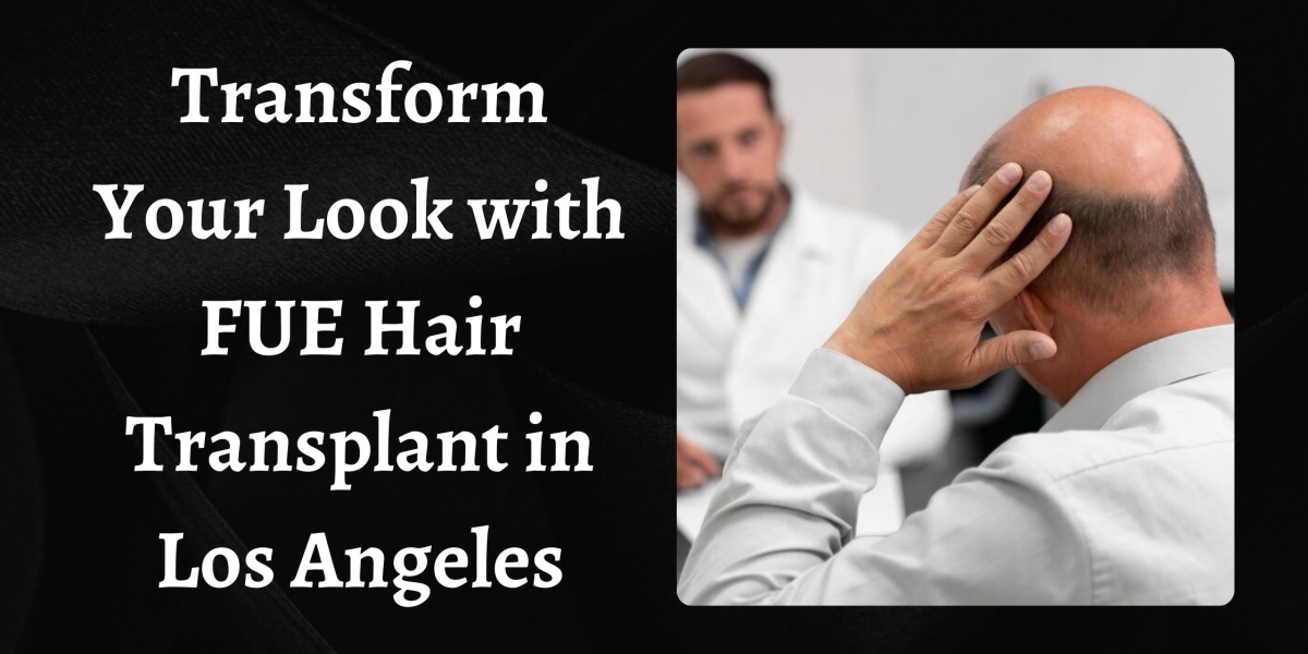 Transform Your Look with FUE Hair Transplant in Los Angeles