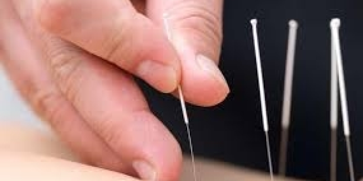 Acupuncture for Sports Performance: 2024 Scientific Insights