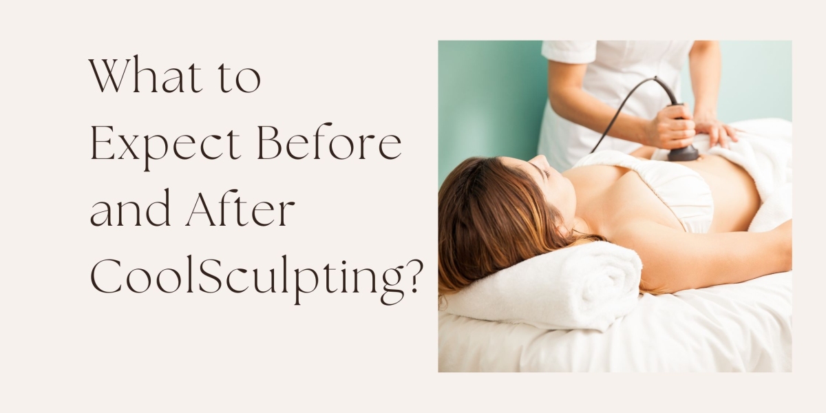 What to Expect Before and After CoolSculpting?