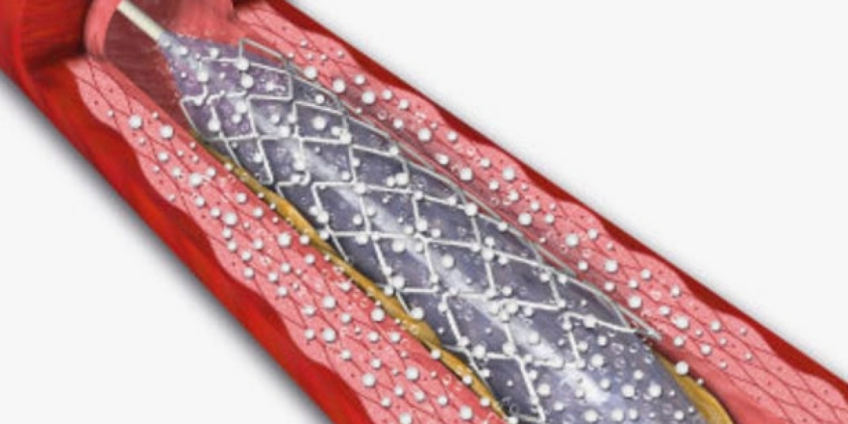 Drug-Eluting Stent Market | Advancing Cardiovascular Care with Precision