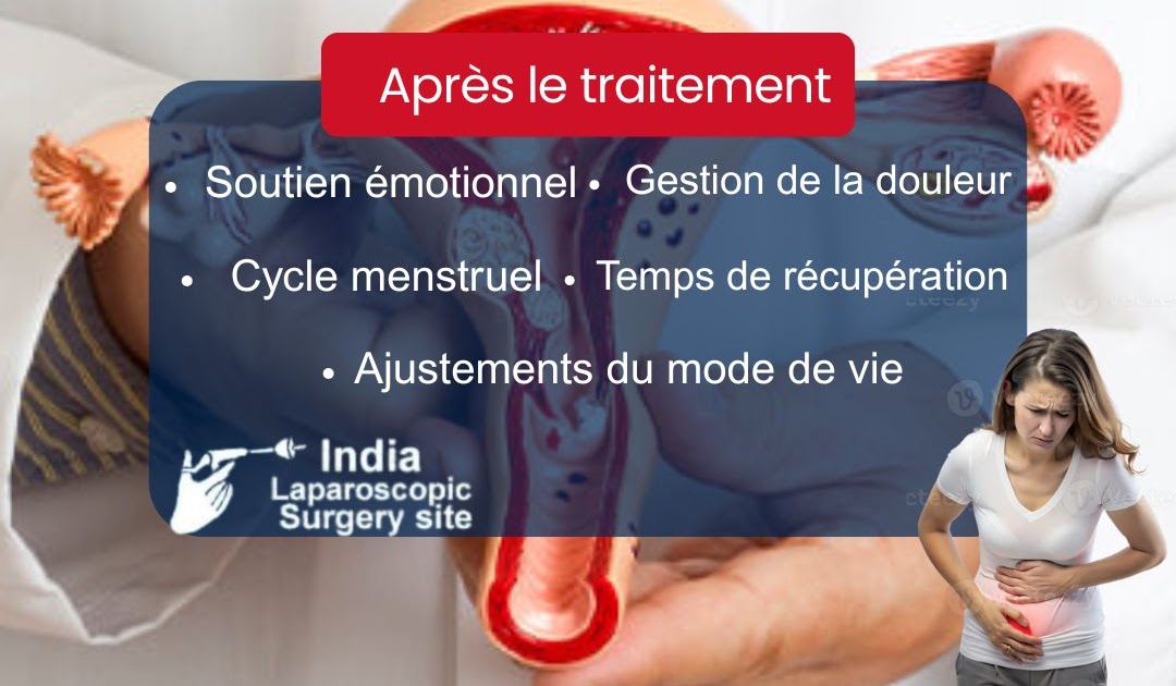 Meilleure Option de Chirurgien Indien Pour les Pays Français: Meilleurs experts en Inde pour la transformation des soins : chirurgiens spécialisés dans la myomectomie