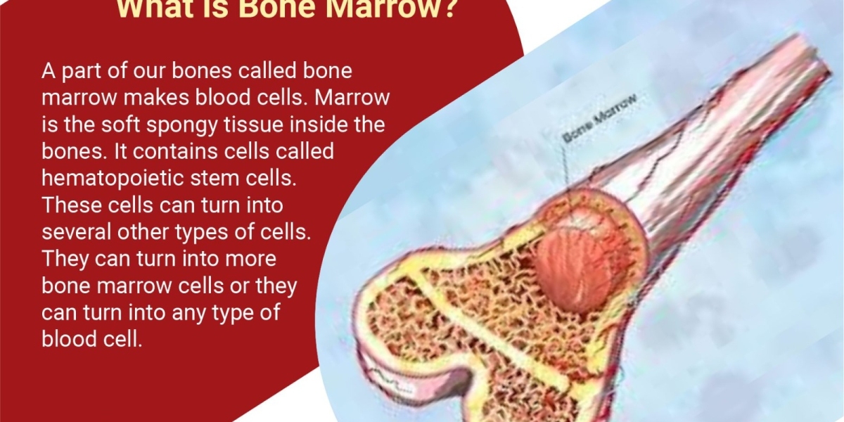 Bone marrow transplant in Hyderabad—Dr. SK Gupta