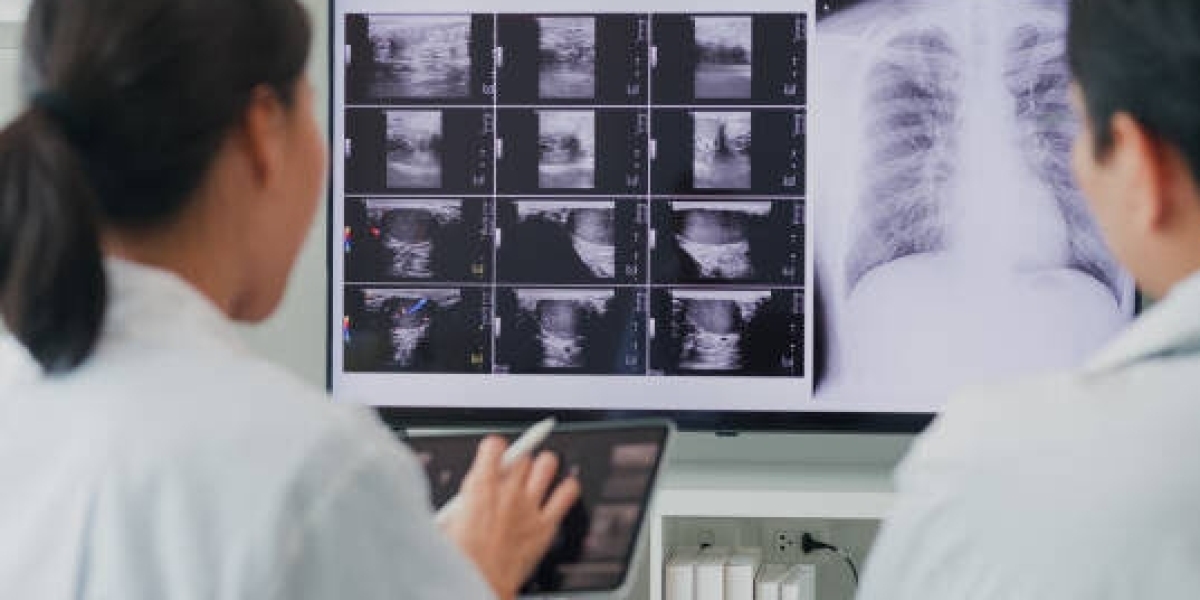 Affordable Imaging Solutions: Buy a Used X-ray Machine Today